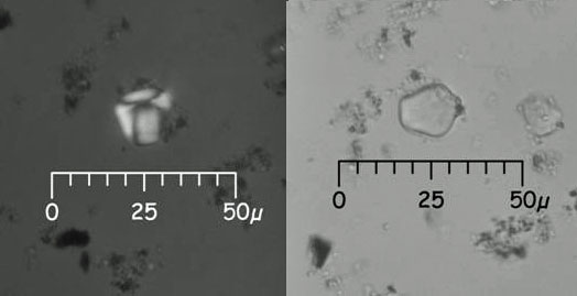 Grain d’amidon (Marantacées) sous lentille polarisante (gauche) et sans lentille polarisante (droite).